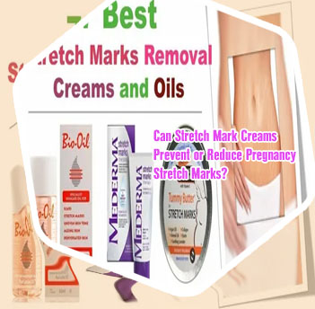 Best stretch mark cream